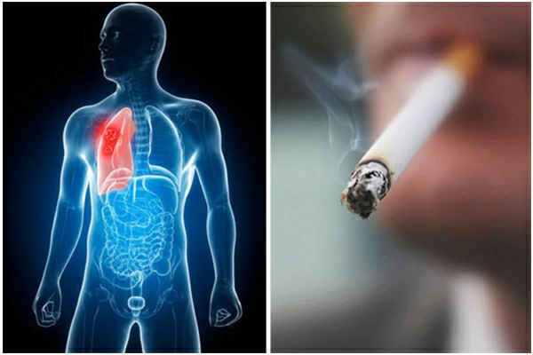 Smoking is harmful to the lungs-600x400px Smoking is harmful to the lungs